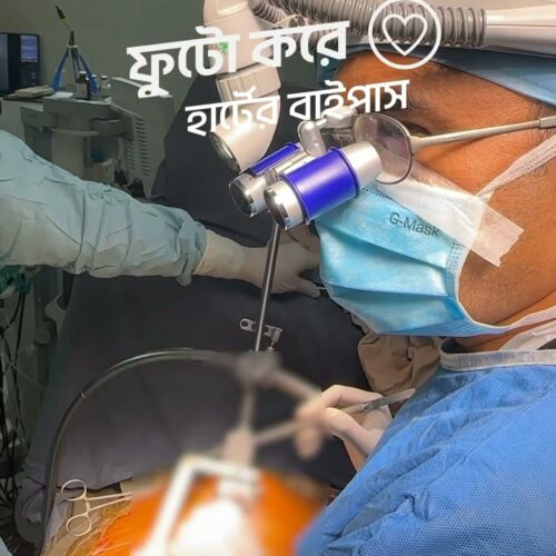 ফুটো করে হার্টের বাইপাস