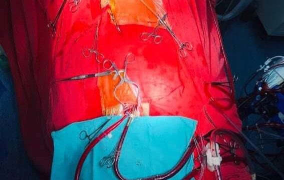 Emergency Heart Surgery